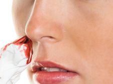 Man cuts sister-in-law's nose for spurning his advances in UP