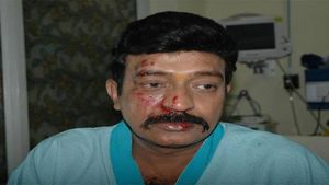  Telugu actor Dr Rajasekhar suffers minor injuries in road accident 