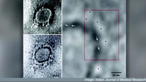 Coronavirus outbreak: Scientists in Pune capture first image of COVID-19