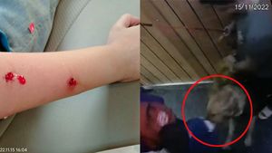 Caught on camera: Pet dog bites schoolboy in lift in Greater Noida 