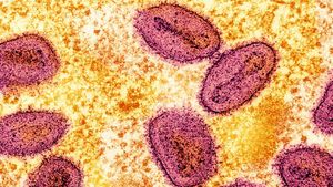 Monkeypox Advisory In Mumbai: Congress Urges Strict Monkeypox Measures At Airport