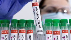 Amid Nipah Scare, Kerala Reports Suspected Monkeypox Case