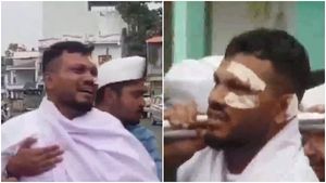 Ahmedabad Plane Crash Survivor Vishwas Kumar Ramesh Discharged From Hospital; Attends Brother's Cremation