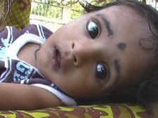 ಹಸುಗೂಸಿಗೆ ಹೃದ್ರೋಗ, ಚಾಚಿಬಂದ ಸಹಾಯಹಸ್ತ