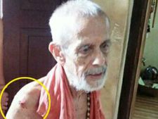 ಪೇಜಾವರ ಶ್ರೀಗಳ ಪುಟ್ಟ ಗಾಯಕ್ಕೆ ಸಿಕ್ಕಿತು ಬೆಟ್ಟದಷ್ಟು ಪ್ರಚಾರ