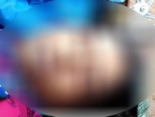 ಬಾಗಲಕೋಟೆ: ವೈದ್ಯರ ನಿರ್ಲಕ್ಷ್ಯಕ್ಕೆ ಬಲಿಯಾದ ತಾಯಿ-ಮಗು