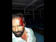 ಬಿಜೆಪಿ ಸಮಾವೇಶದಿಂದ ಹಿಂತಿರುಗುತ್ತಿದ್ದ ಬಸ್ ಮೇಲೆ ಕಲ್ಲು ತೂರಾಟ