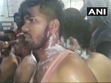 ಕಾಂಗ್ರೆಸ್ ಕಾರ್ಯಕರ್ತರ ಮೇಲೆ ಆಸಿಡ್‌ ದಾಳಿ, 25 ಜನ ಗಾಯಾಳು