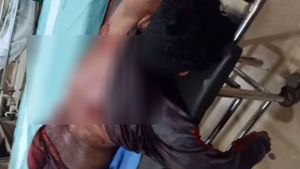 BREAKING: ಮಂಗಳೂರಿನಲ್ಲಿ ಸಿಡಿದ ಪೊಲೀಸ್ ಗುಂಡು; ಮೂವರ ಸ್ಥಿತಿ ಗಂಭೀರ
