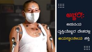 ಅಚ್ಚರಿ: ಉಡುಪಿಯ ವ್ಯಕ್ತಿಯೊಬ್ಬರ ದೇಹದಲ್ಲಿ ಅಯಸ್ಕಾಂತೀಯ ಶಕ್ತಿ 