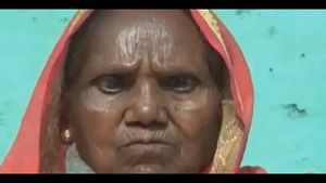 ಎಂಥಾ ಅಚ್ಚರಿ: ಕೊರೊನಾ ಲಸಿಕೆ ಪಡೆದ ಬಳಿಕ ಮರಳಿತು ಕಣ್ಣಿನ ದೃಷ್ಟಿ