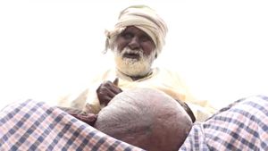  15 ವರ್ಷದಿಂದ ಹೊಟ್ಟೆಯೊಳಗೆ ಬೆಳೆದ ಬೃಹತ್ ಗಡ್ಡೆ, ವೃದ್ಧನ ನರಕಯಾತನೆ 