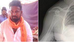 ಕಾಂಗ್ರೆಸ್ ತೊರೆದು ಬಿಜೆಪಿ ಸೇರ್ಪಡೆಯಾಗಿದ್ದ ಕಾರ್ಯಕರ್ತನ ಮೇಲೆ ಮಾರಣಾಂತಿಕ ಹಲ್ಲೆ