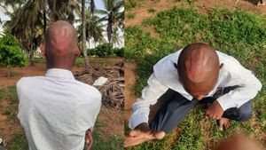  ಗುಂಡ್ಲುಪೇಟೆ: ಹಸ್ತದ ಗುರುತಿನ ಹೇರ್ ಕಟಿಂಗ್ ಮಾಡಿಸಿಕೊಂಡು ಗಮನ ಸೆಳೆದ ಅರೇಪುರದ ವ್ಯಕ್ತಿ