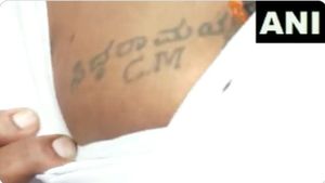 Siddaramaiah: ಸಿದ್ದರಾಮಯ್ಯ ಸಿಎಂ ಎಂದು ಎದೆಯ ಮೇಲೆ ಟ್ಯಾಟೂ ಹಾಕಿಸಿಕೊಂಡ ಅಭಿಮಾನಿ