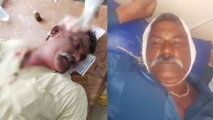  Varuna: ವರುಣಾದಲ್ಲಿ ಬಿಜೆಪಿ ಬೂತ್ ಅಧ್ಯಕ್ಷನ ಮೇಲೆ ಹಲ್ಲೆ; ರಕ್ತಸಿಕ್ತ ರಾಜಕೀಯಕ್ಕೆ ಮುನ್ನುಡಿ ಬರೀತಾ ಕಾಂಗ್ರೆಸ್?