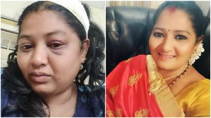 ಶಿವಮೊಗ್ಗ: ಜಮೀನು ವಿವಾದ, ಕೆಂಪೇಗೌಡ ಚಿತ್ರದ ನಟಿಯ ಮೇಲೆ ಹಲ್ಲೆ