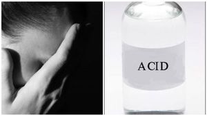 Acid Attack: ಕಡಬದಲ್ಲಿ ಮೂವರು ವಿದ್ಯಾರ್ಥಿನಿಯರ ಮೇಲೆ ಆ್ಯಸಿಡ್ ದಾಳಿ