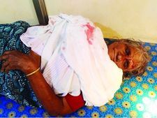 തെരുവുനായയുടെ ആക്രമണം:  വയോധികയ്ക്ക് ഗുരുതരമായി പരുക്കേറ്റു