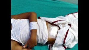 ഏഴു വയസുകാരന് ശസ്ത്രക്രിയ ചെയ്ത സംഭവം;  മഞ്ചേരി മെഡിക്കല്‍ കോളജ് അധികൃതർക്ക് പറ്റിയ തെറ്റ്, മെഡിക്കൽ കോളേജ് സൂപ്രണ്ടിന്റെ റിപ്പോർട്ട് ഇങ്ങനെ...