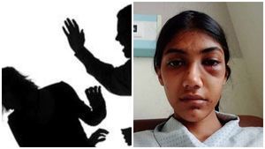 ഭര്‍തൃമാതാവിന്റെ സുഹൃത്തിന്റെ ക്രൂരമര്‍ദത്തിനിരയായി യുവതി, മുഖത്ത് ഇടിയേറ്റ് ഗുരുതരാവസ്ഥയില്‍