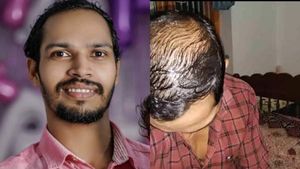പ്രശാന്തിന് സംഭവിച്ചതെന്ത്: മുടികൊഴിച്ചിലിനുള്ള മരുന്ന് നല്‍കി ചതിച്ചോ? ഡോക്ടറിനും പറയാനുണ്ട്