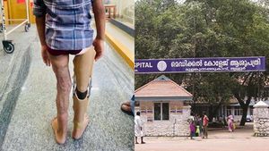  ഇനി നടക്കും കൃത്രിമ കാലിലൂടെ; അഞ്ചു വയസുകാരന്റെ സ്വപ്‌നം സഫലമാക്കി തൃശൂര്‍ മെഡിക്കല്‍ കോളേജ്