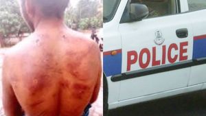 മതപാഠശാല വിദ്യാർത്ഥിയെ അതിക്രൂരമായി പീഡിപ്പിച്ചു; മദ്രസ അധ്യാപകനെതിരെ വധശ്രമത്തിന് കേസെടുത്തു