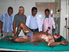 ராஜபக்சேவை போர்க் குற்றவாளியாக அறிவிக்கக் கோரி கடலூரில் ஒருவர் தீக்குளிப்பு!