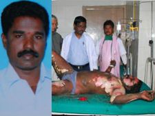ராஜபக்சேவை எதிர்த்துத் தீக்குளித்த கடலூர் மணி மரணம்