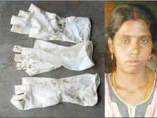 அறுவை சிகிச்சையின்போது பெண்ணின் வயிற்றுக்குள் 3 கையுறைகளை வைத்து தைத்த அரசு மருத்துவர்கள்