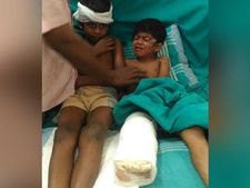 விபத்தில் காலை இழந்த தம்பி, தலையில் காயம்பட்ட அண்ணன்: உதவி கேட்டு மன்றாடும் தந்தை 