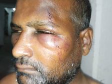 இளைஞருக்கு சரமாரி பைப் அடி, கத்திக் குத்து.. அதிமுக எம்எல்ஏ தம்பி மீது பரபர புகார்