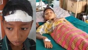 டியூசன் சென்ற மாணவன்.. இரும்பு வாளியால் புரட்டி எடுத்த டீச்சர்.. தலையில் 8 தையல்!