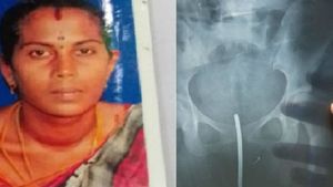 பிரசவத்துக்கு போன கர்ப்பிணி.. உடைந்த ஊசியை வயிற்றில் வைத்து தைத்த நர்ஸ்.. முற்றுகை.. பரபரப்பு! 