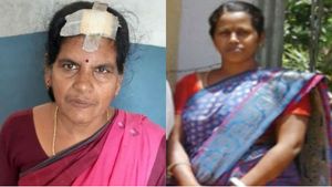 கல்பனாவுக்கு வந்த கடும் கோபம்.. மாமியார் தலையை பிடித்து.. பலத்த கடி.. 6 தையல்.. ஷாக் சம்பவம்! 
