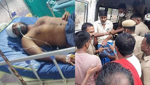 காடுவெட்டி குரு மகன், மருமகனுக்கு அரிவாள் வெட்டு -மருத்துவமனையில் சிகிச்சை 