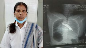 நெஞ்சில் ஆழமாக பாய்ந்த கத்தி.. 30 மணி நேரமாக போராடிய மல்லிகா.. காப்பாற்றிய கோவை அரசு மருத்துவமனை 