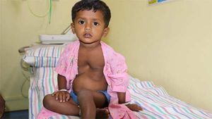 இதய நோயினால் அவதிப்படும் 2 வயது சிறுமி பிருந்தா உயிர் பிழைக்க உதவுங்களேன்