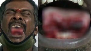 என்ன ஒரு பைத்தியகாரத்தனம்..  கவரில் இருந்ததை பார்த்து  அதிர்ச்சி அடைந்த மருத்துவர்கள்.. ஓசூரில் ஷாக் 