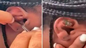 கடலில் குளித்தபோது விபரீதம்.. காதுக்குள் நுழைந்த குட்டி நண்டு..  படாதபாடுபட்டு வெளியில் எடுத்த பெண்!