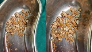 வயிறா இல்லை குவாரியா? கிட்னியில் 206 சிறுநீரக கற்கள்..! தலைசுற்றிப் போன மருத்துவர்கள்? என்ன ஆச்சு..? 