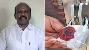 தமிழகத்தை உலுக்கிய கருமுட்டை விற்பனை.. மாசுவின் ஆர்டர் - சேலம் மருத்துவமனைக்கு விரைவில் சீல் 