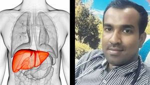 fatty liver என்றால் என்ன? சிகிச்சை என்ன? அலட்சியம் செய்தால் புற்றுநோய் வரும்! டாக்டர் பரூக் விளக்கம்