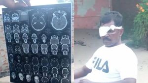 நடுக்கடல்.. நள்ளிரவு.. தமிழர்களுக்கு நடந்த சித்திரவதை! இலங்கை கடற்படை தாக்கி பார்வையிழந்த மீனவர் 