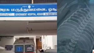 பச்சிளம் குழந்தையின் உயிரோடு விளையாடிய நர்ஸ்கள்..மூன்றாக உடைந்த கை..ஓசூரில் பரபரப்பு 