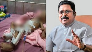 குழந்தையின் கை அகற்றம்.. அரசு மருத்துவமனை அலட்சியம்.. கொந்தளித்த டிடிவி தினகரன் 