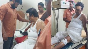 வாக்கிங் போன மனுஷனுக்கு வந்த சோதனை! கால் இடறி கீழே விழுந்த கே.எஸ்.அழகிரி! நெற்றி, முழங்காலில் காயம்! 