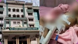 கை அகற்றப்பட்ட ராமநாதபுரம் குழந்தை இறப்பு ஏன்? உடல் முழுவதும் பரவிய தொற்று.. மருத்துவர்கள் விளக்கம் 