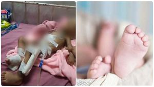 உயிரே போச்சே.. சென்னையில் கை அகற்றப்பட்ட ஒன்றரை வயது குழந்தை நினைவிருக்கா? காலமானதாக அதிர்ச்சி தகவல் 